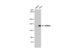 KDM6A Antibody in Western Blot (WB)