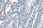 B-Raf Antibody in Immunohistochemistry (Paraffin) (IHC (P))