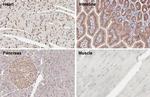 beta Catenin Antibody in Immunohistochemistry (Paraffin) (IHC (P))