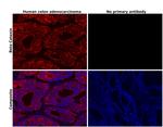 beta Catenin Antibody in Immunohistochemistry (Paraffin) (IHC (P))