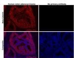 beta Catenin Antibody in Immunohistochemistry (Paraffin) (IHC (P))