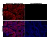 beta Catenin Antibody in Immunohistochemistry (Paraffin) (IHC (P))