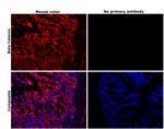 beta Catenin Antibody in Immunohistochemistry (Paraffin) (IHC (P))