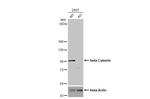 beta Catenin Antibody in Western Blot (WB)