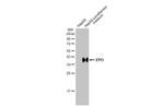 Epo Antibody in Western Blot (WB)