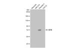 BTK Antibody in Western Blot (WB)