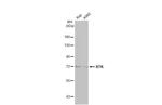 BTK Antibody in Western Blot (WB)