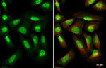 METTL14 Antibody in Immunocytochemistry (ICC/IF)