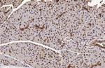 METTL14 Antibody in Immunohistochemistry (Paraffin) (IHC (P))