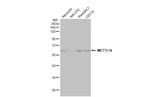 METTL14 Antibody in Western Blot (WB)