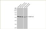 METTL14 Antibody in Western Blot (WB)