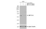 METTL14 Antibody in Western Blot (WB)