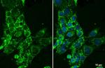 CYP27A1 Antibody in Immunocytochemistry (ICC/IF)