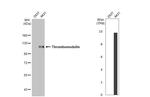 Thrombomodulin Antibody in Western Blot (WB)