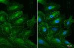 MLKL Antibody in Immunocytochemistry (ICC/IF)