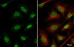 Nurr1 Antibody in Immunocytochemistry (ICC/IF)