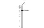 TRIM72 Antibody in Western Blot (WB)