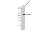 TRIM72 Antibody in Western Blot (WB)