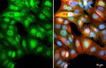 BATF Antibody in Immunocytochemistry (ICC/IF)