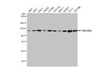 Vinculin Antibody in Western Blot (WB)