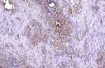 ZC3HAV1 Antibody in Immunohistochemistry (Paraffin) (IHC (P))