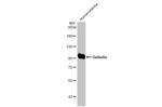 Gelsolin Antibody in Western Blot (WB)