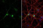 DLX2 Antibody in Immunocytochemistry (ICC/IF)