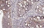 Apolipoprotein B Antibody in Immunohistochemistry (Paraffin) (IHC (P))