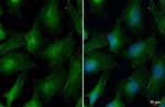 Vinculin Antibody in Immunocytochemistry (ICC/IF)