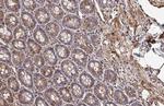 Vinculin Antibody in Immunohistochemistry (Paraffin) (IHC (P))