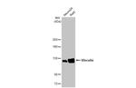 Vinculin Antibody in Western Blot (WB)