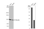 Vinculin Antibody in Western Blot (WB)