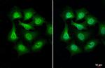 PIP5K1A Antibody in Immunocytochemistry (ICC/IF)