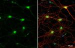 ChAT Antibody in Immunocytochemistry (ICC/IF)