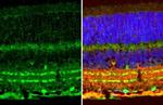 ChAT Antibody in Immunohistochemistry (Paraffin) (IHC (P))