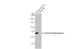 ChAT Antibody in Western Blot (WB)