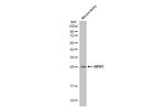 HPRT1 Antibody in Western Blot (WB)