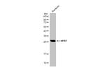 HPRT1 Antibody in Western Blot (WB)