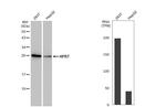 HPRT1 Antibody in Western Blot (WB)