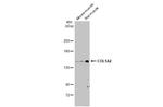 COL1A2 Antibody in Western Blot (WB)