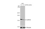 LRP130 Antibody in Western Blot (WB)