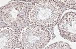 BRPF1 Antibody in Immunohistochemistry (Paraffin) (IHC (P))