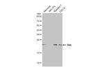 SHH Antibody in Western Blot (WB)