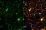 Synapsin II Antibody in Immunocytochemistry (ICC/IF)