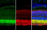 Synapsin II Antibody in Immunohistochemistry (Paraffin) (IHC (P))