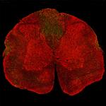 NEFL Antibody in Immunohistochemistry (PFA fixed) (IHC (PFA))