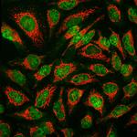 MBNL1 Antibody in Immunocytochemistry (ICC/IF)