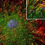 ALDH1L1 Antibody in Immunocytochemistry (ICC/IF)