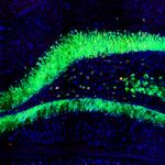 c-Fos Antibody in Immunohistochemistry (IHC)