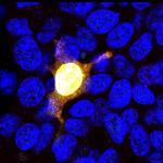 Cas9 Antibody in Immunocytochemistry (ICC/IF)